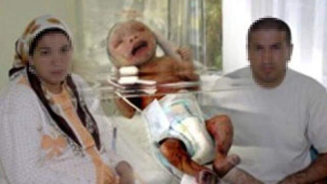 Bir dönem tüm Türkiye onu konuşuyordu! İşte herkesten saklanan yılan bebeğin akıbeti