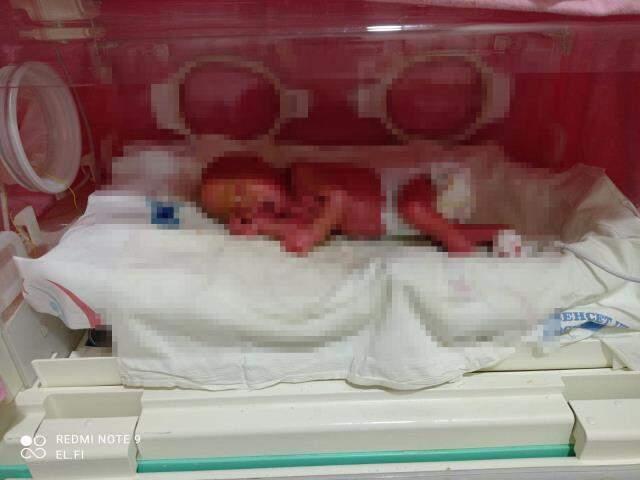 Tüm Türkiye onu merak ediyor! İşte hayatta kalabilen yılan bebeğin en net fotoğrafları