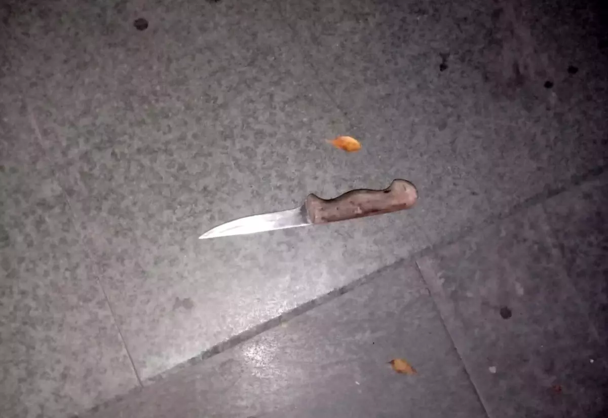 'Gel sana sarılayım' deyip kalçasından bıçakladı