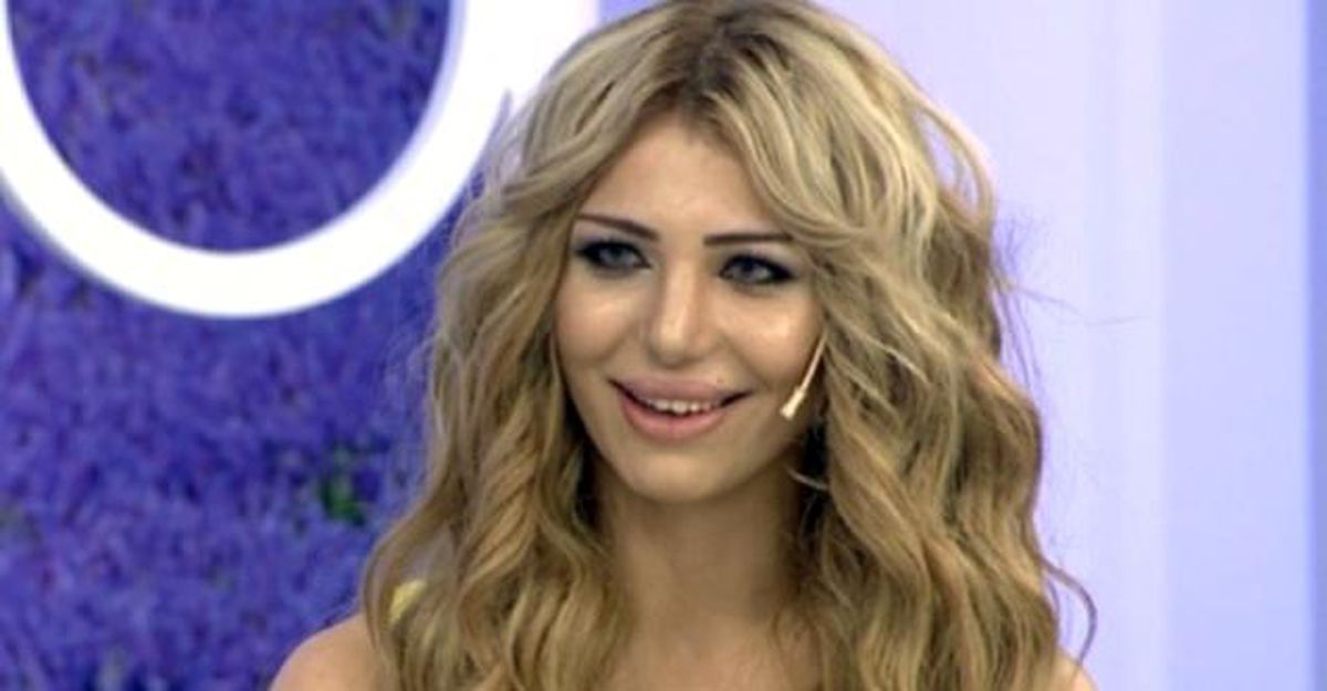Gelin adayı Esmira estetikle bambaşka biri oldu