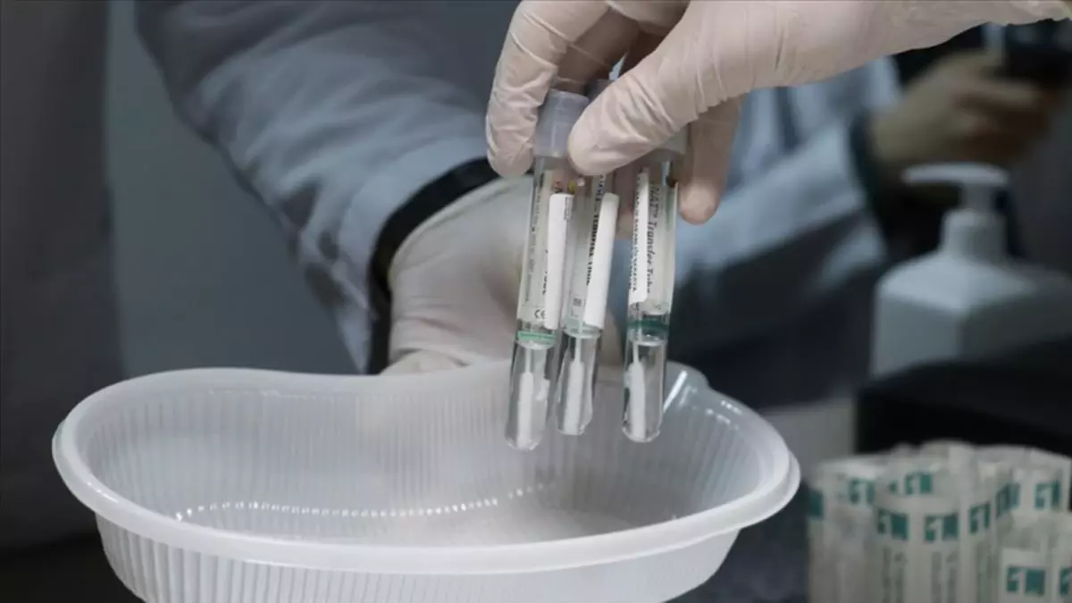 Sağlık ocakları PCR testi yapıyor mu? PCR testi nerelerde yapılır?