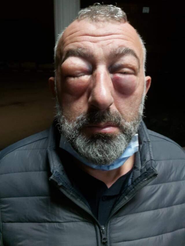 'Şerefsiz' dediği şoför diğer şoförün babası çıkınca feci şekilde darp edildi