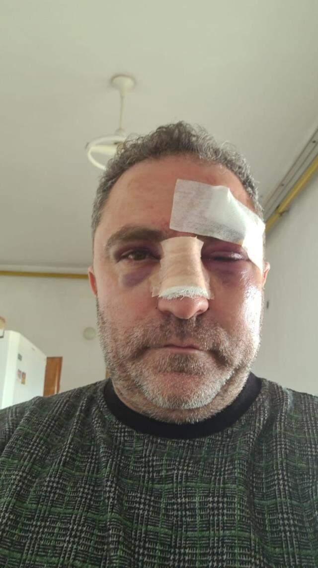 Fabrika işçisini öldüresiye dövüp kendi sosyal medya hesabından canlı yayınladılar