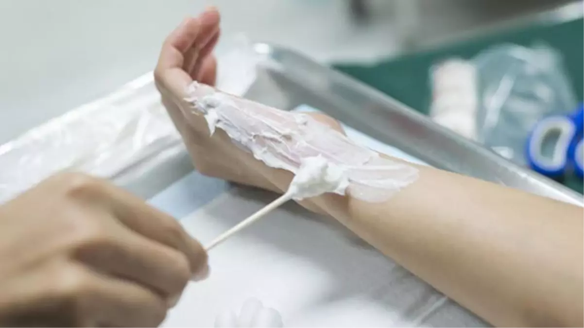 Küçük çocuğun elini ve yüzünü sıcak yemek kaşığıyla yakan amca gözaltına alındı