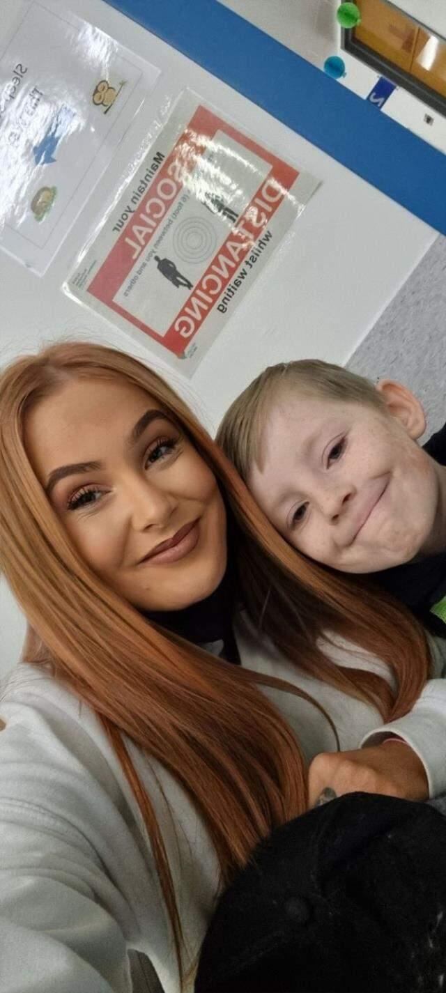 Yılan gibi her gün deri değiştiren çocuğun fotoğrafları görenleri korkuttu Yılan gibi her gün deri değiştiren çocuğun fotoğrafları görenleri korkuttu