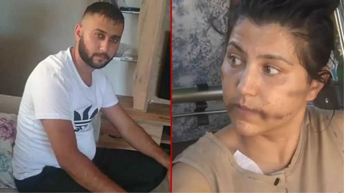Eşi tarafından 104 yerinden bıçaklandığı söylenen kadının olayında kürsüye çıkan herkes farklı konuştu