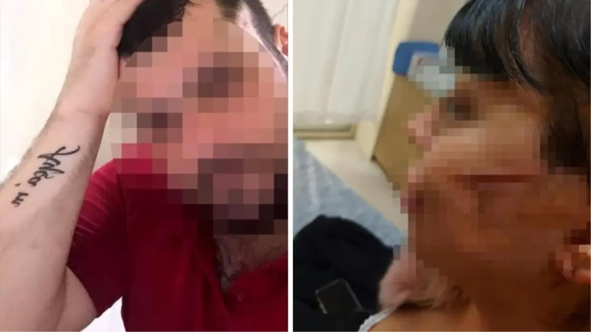 Saplantılı aşık dehşeti! Önce darp etti, sonra ustura ile yüzünü kesti