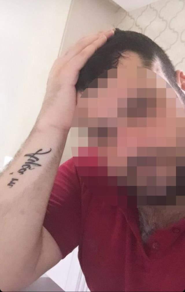 Saplantılı aşık dehşeti! Önce tabancayla vurdu sonra darp edip yüzünü kesti