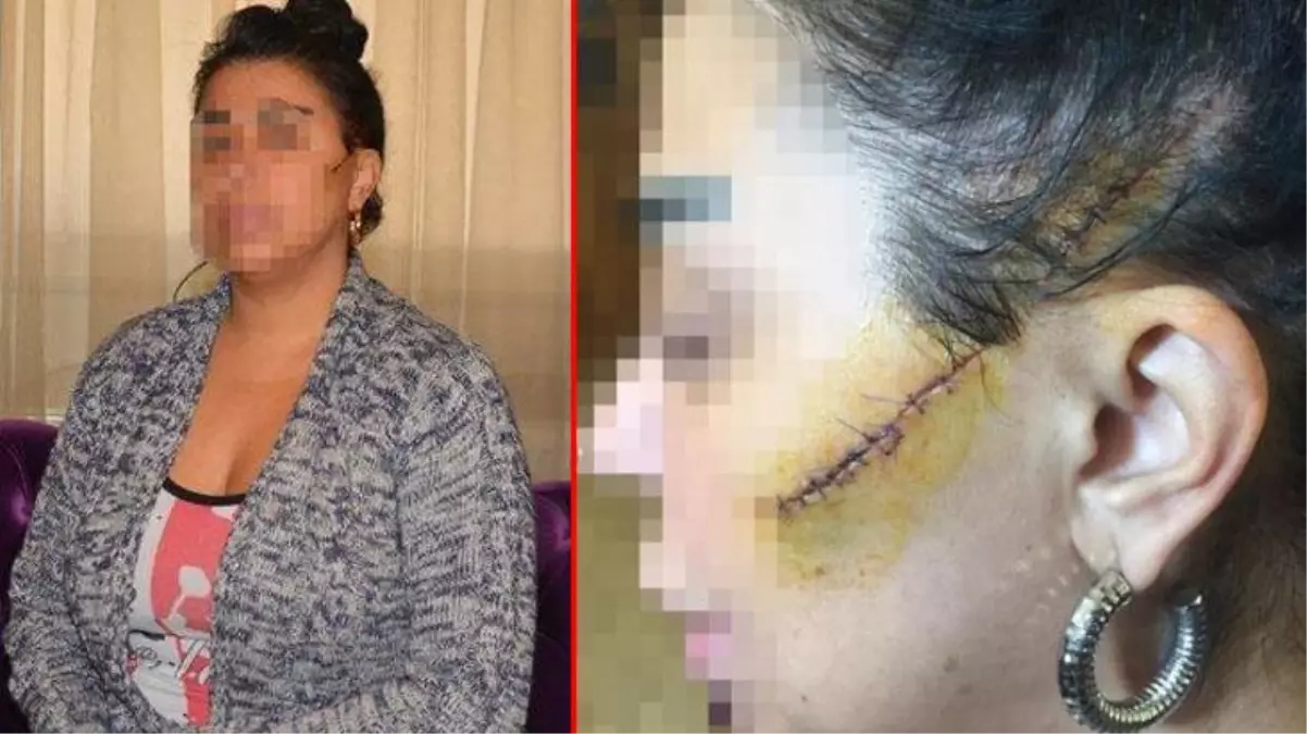 Saplantılı aşık dehşeti! Önce tabancayla vurdu sonra darp edip yüzünü kesti