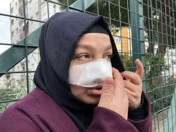 Spor yaparken pitbull saldırısında burnundan yaralandı