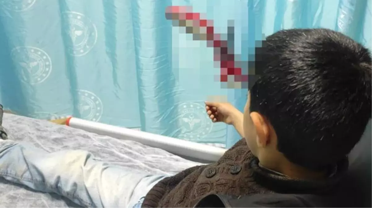 10 yaşındaki çocuğun kafasına saplanan makasla hastaneye getirildi