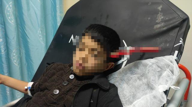 10 yaşındaki çocuğun kafasına saplanan makasla hastaneye getirildi