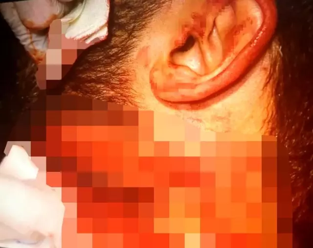 İzmir'de doktoru boğazından jiletle yaralayan sanığa 18 yıl hapis