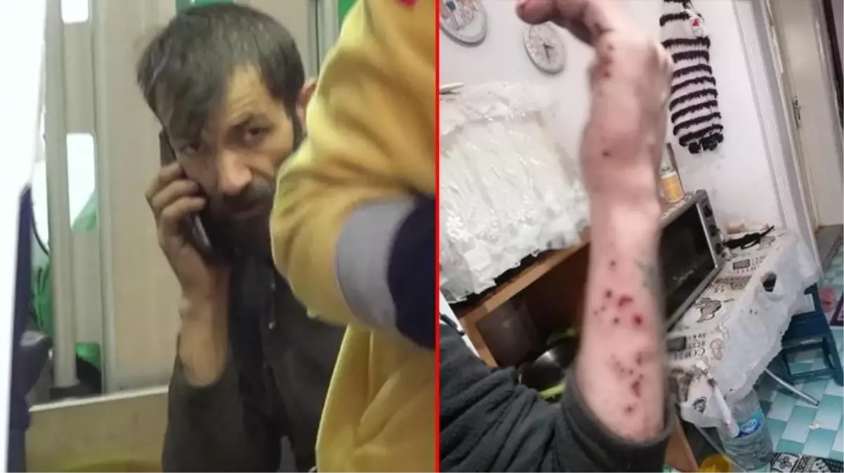 Hurdacı kabusu yaşadı! Topladığı malzemelerin arasından çıkan bomba fünyesi elinde patladı