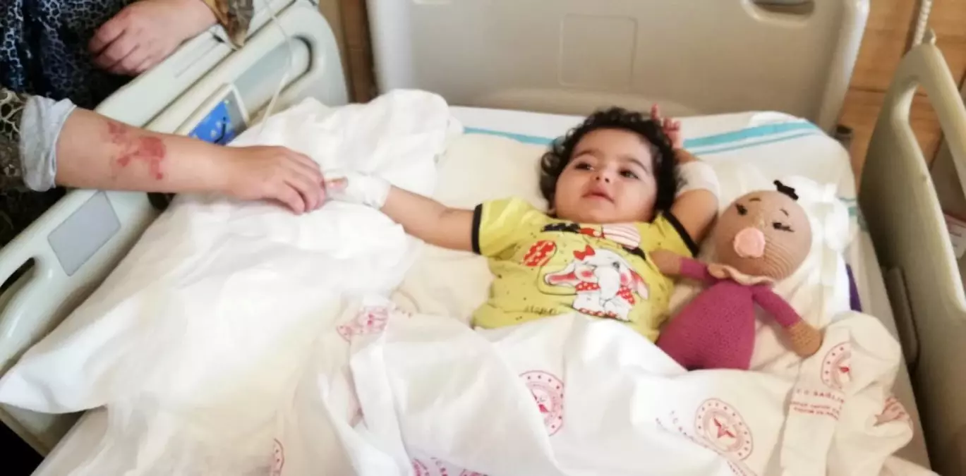 Sobadan devrilen çaydanlık minik Eslem'i yaktı