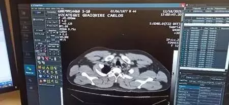 İstanbul Havalimanı'ndan bir garip olay! Uyuşturucu kuryesi bayılınca yakayı ele verdi İstanbul Havalimanı'ndan bir garip olay! Uyuşturucu kuryesi bayılınca yakayı ele verdi