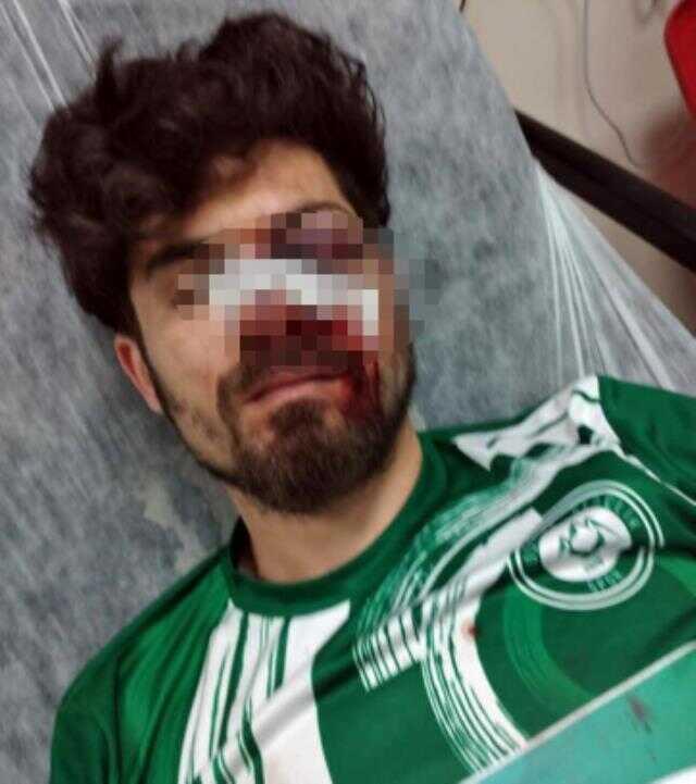 Kırmızı kart gören futbolcu, yerde yatan rakibinin yüzüne tekme atıp yaraladı Kırmızı kart gören futbolcu, yerde yatan rakibinin yüzüne tekme atıp yaraladı