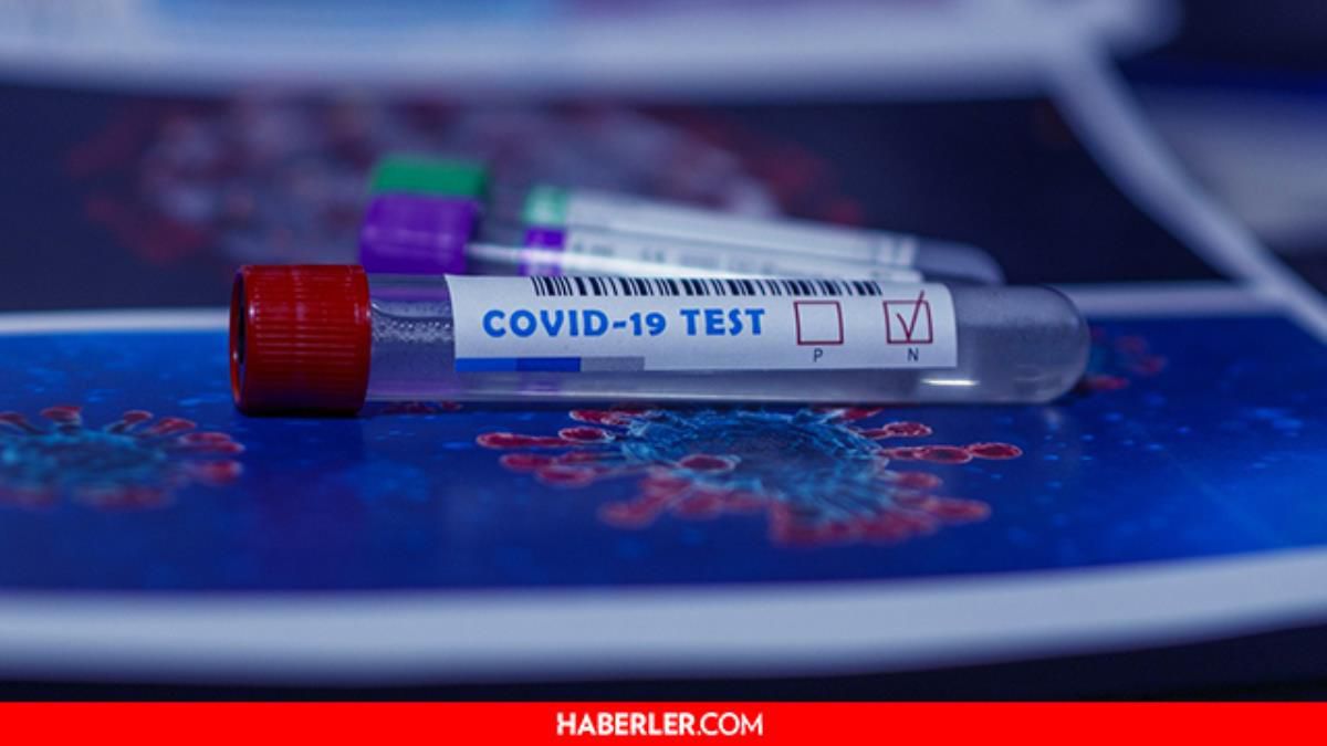 Covid testi sonucu ne zaman çıkar? 2022 Korona testi ne zaman belli olur?