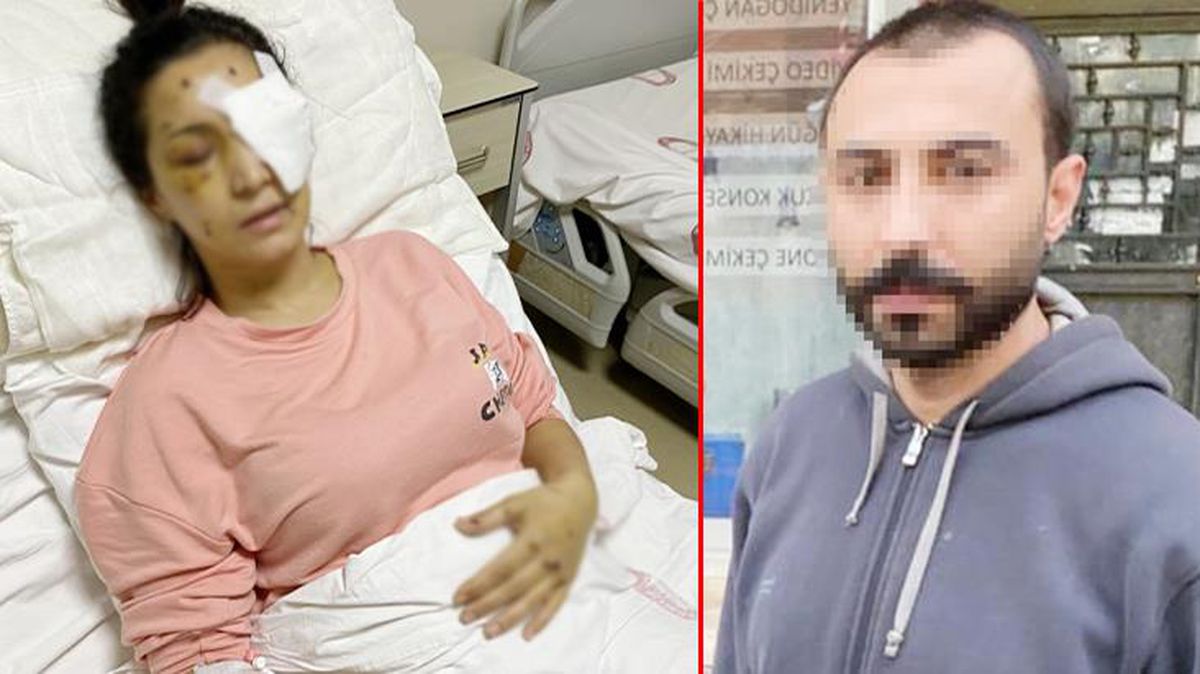 Kendisine 'ağabey'' demeyen yengesini, 37 yerinden bıçaklayıp kör etti