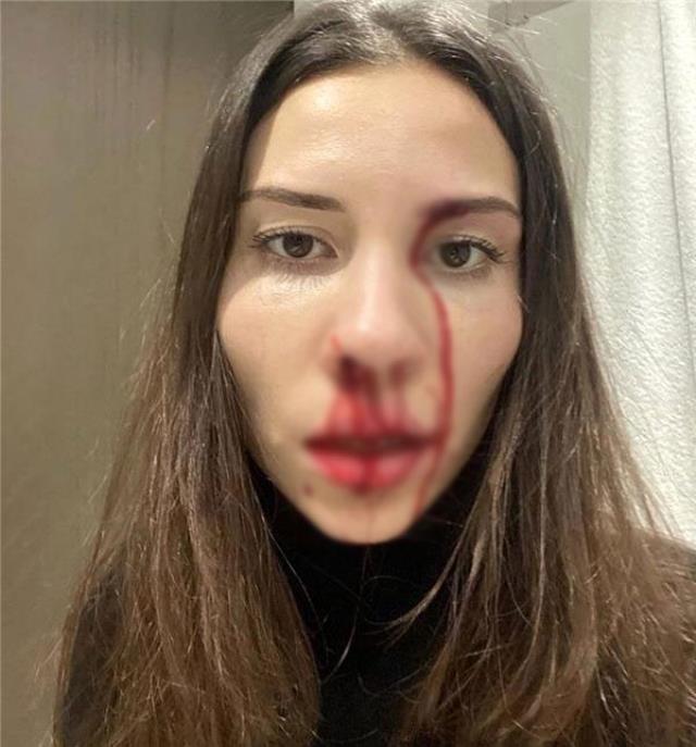 Eşini dövdüğü iddia edilen Özer Hurmacı sessizliğini bozdu: Gerçeği yansıtmıyor Eşini dövdüğü iddia edilen Özer Hurmacı sessizliğini bozdu: Gerçeği yansıtmıyor