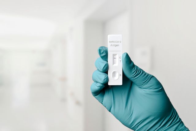 İBB Bilimsel Danışma Kurulu'ndan hızlı test çağrısı!