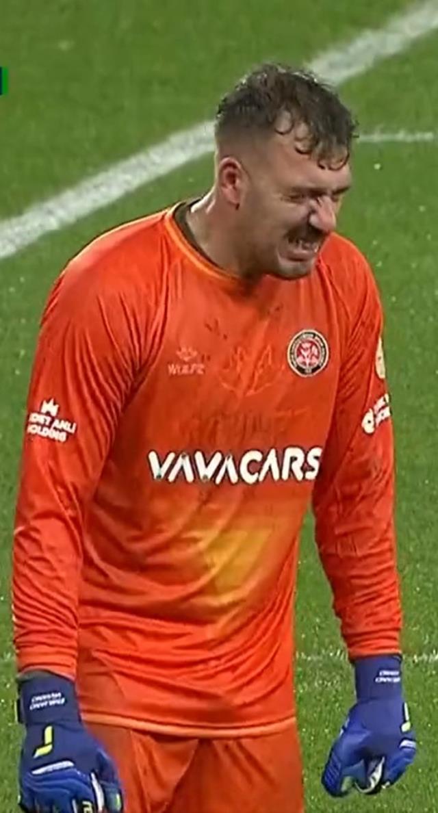 Kaskatı kesilip acı çekti! Karagümrük kalecisinin maçta zangır zangır titrediği anlar gündeme oturdu