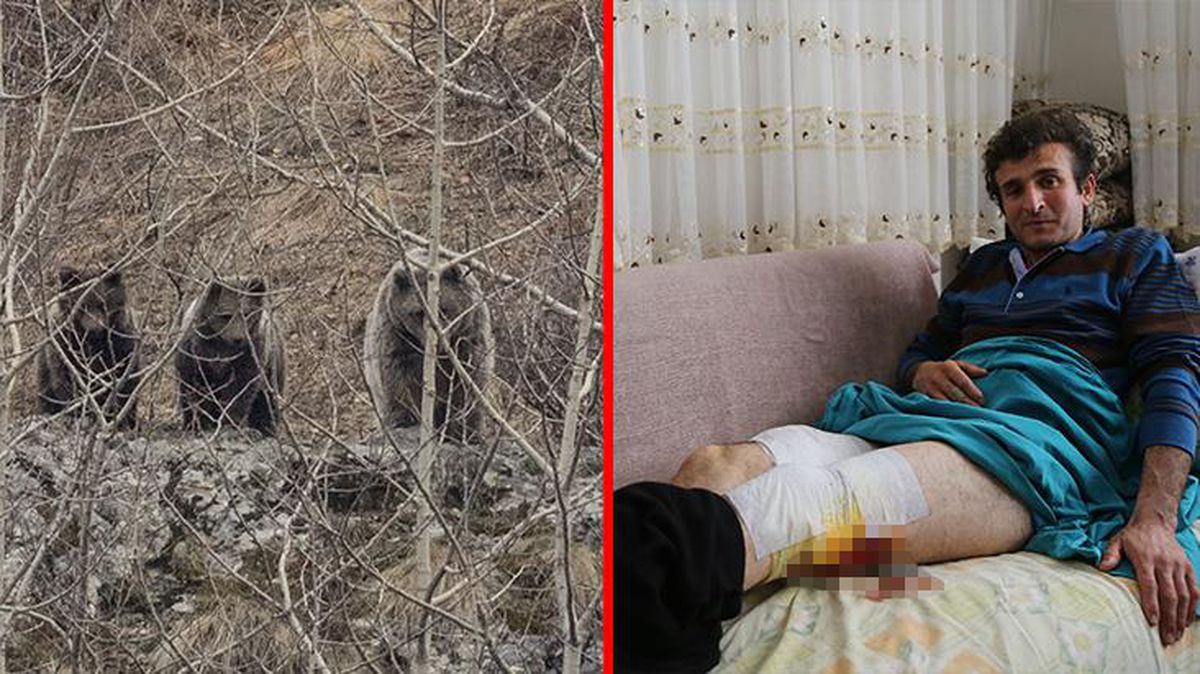Ayının saldırdığı engelli vatandaş, arkadaşını görüntülü arayıp yaralarını göstererek yardım istedi