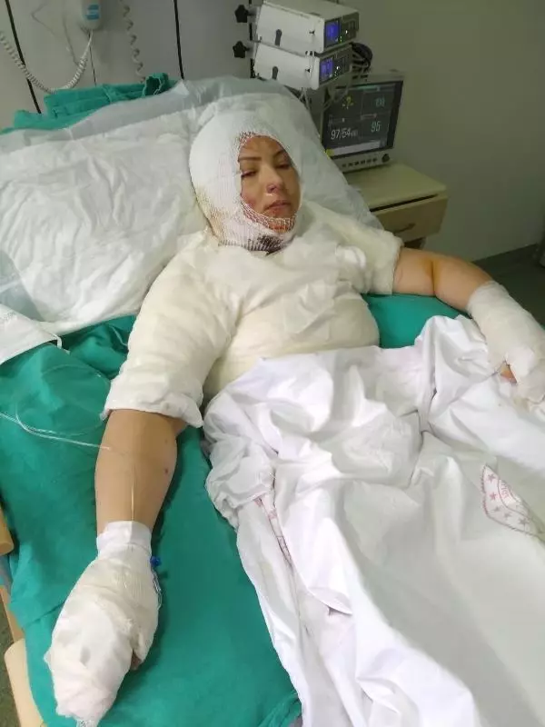 Eski eşi tarafından ateşe verilen talihsiz kadından kan donduran sözler: Söndürmeye çalışmadı, yanmamı izledi