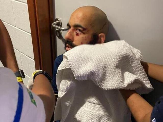 Eski Trabzonsporlu Rodallega'nın olduğu otobüse bombalı saldırı! Yaralı futbolcular var Eski Trabzonsporlu Rodallega'nın olduğu otobüse bombalı saldırı! Yaralı futbolcular var