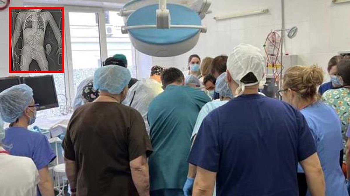 Savaşın korkunç yüzü! Rus bombalarıyla ağır yaralanan çocuğun fotoğrafı yürek parçaladı