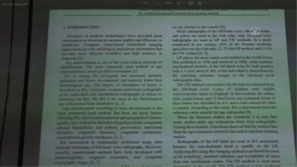 Kemik yaşını yapay zeka ile tespit edecek sistem geliştirildi