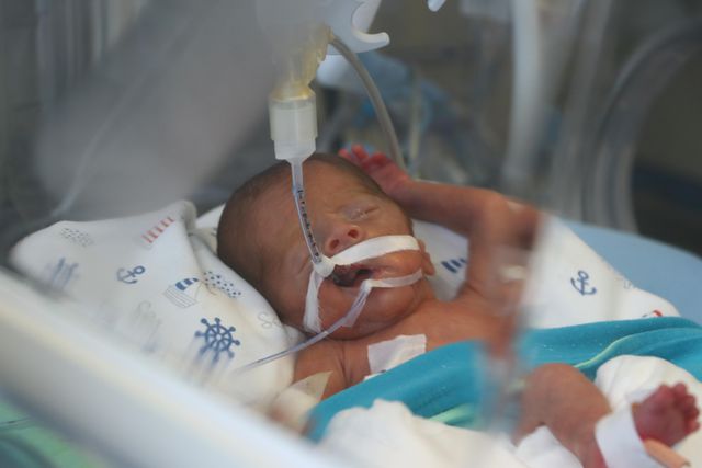 parmak bebek yavuz selim kok hucre nakliyle h 2 14786468 o