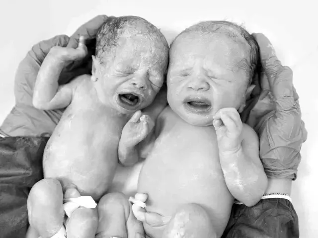 Hamileyken hamile kalarak Türkiye'yi şaşkına çevirmişti! Genç anne ve çocuklarına bir de şimdi bakın