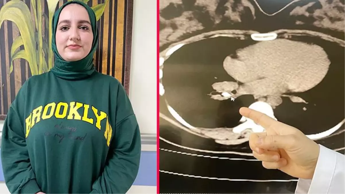 Kanser sanılan kadının soluk borusundan badem zarı çıkarıldı