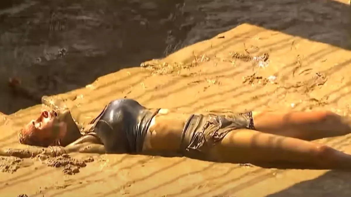 Survivor Sema'ya ne oldu? Survivor Sema SAĞLIK DURUMU nasıl? Sema neden yok?