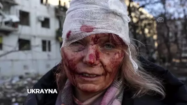 Ukrayna'daki savaşın acıları Suriye'deki dramla benzeri karelere yansıdı