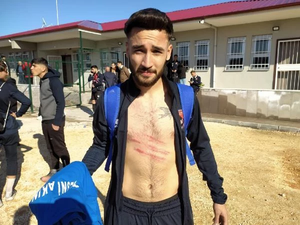 SPOR Adıyaman'da amatör maçta tekme tokat hengame