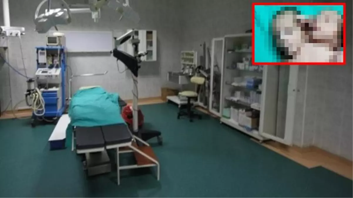 Doğumhane kapısında ikiz bebek bekliyorlardı, çift başlı bebeği görünce dilleri tutuldu
