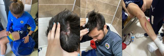 Büyük rezillik! Fenerbahçeli bayan futbolculara tekme tokat saldırdılar