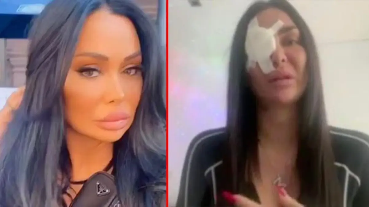 TikTok fenomenine korkunç saldırı! Video çektiği sırada suratına asit attılar