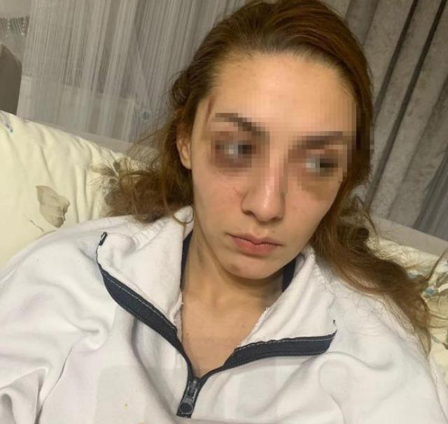 Eşofmanı yüzünden terk edildi, barışma teklifini kabul etmeyince öldüresiye dövüldü Eşofmanı yüzünden terk edildi, barışma teklifini kabul etmeyince öldüresiye dövüldü