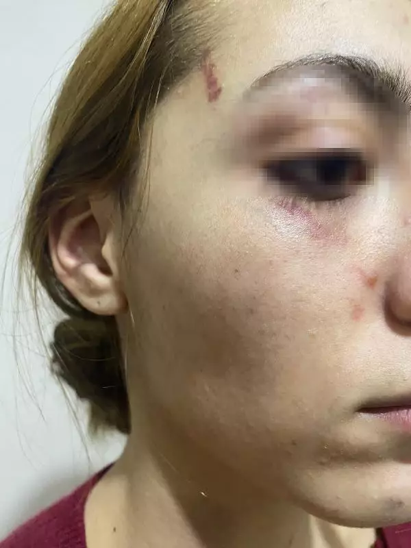 Eşofmanı yüzünden terk edildi, barışma teklifini kabul etmeyince öldüresiye dövüldü Eşofmanı yüzünden terk edildi, barışma teklifini kabul etmeyince öldüresiye dövüldü