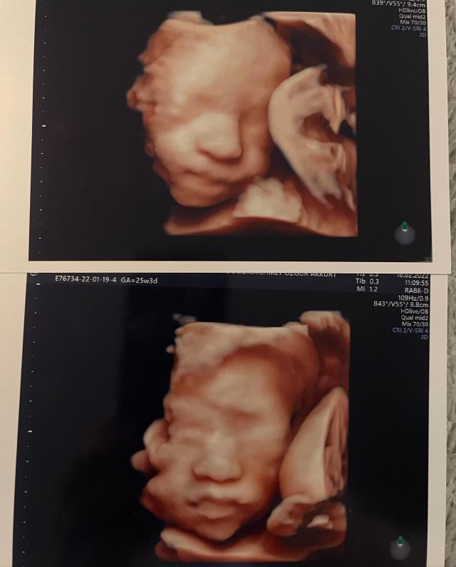 Seray Sever, ikiz bebeklerini dünyaya getirdi Seray Sever, ikiz bebeklerini dünyaya getirdi