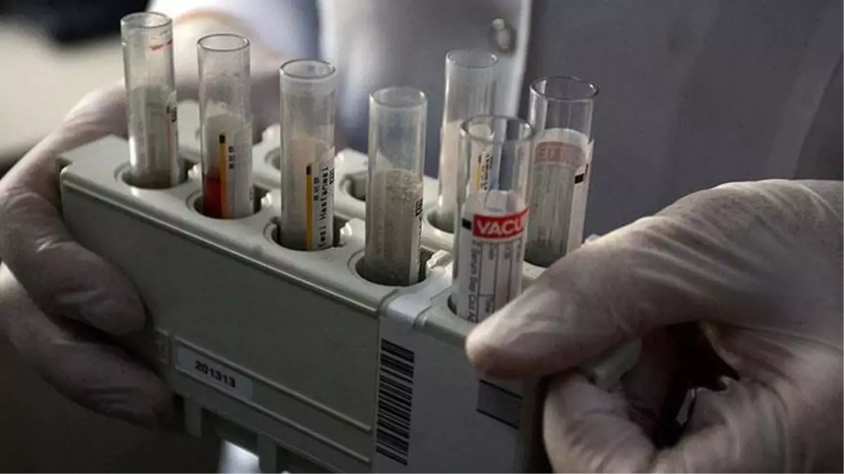 Dünyayı yeni bir küresel salgın mı bekliyor? İngiltere'de ortaya çıkan gizemli hepatit virüsü Avrupa ve ABD'de görüldü