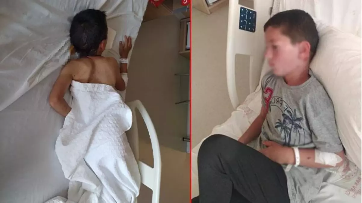 Uçurtmasının peşinden koşan çocuğa 6 köpek birden saldırdı, yardımına sesleri duyan çoban koştu