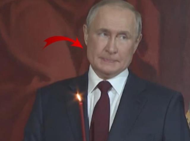 Putin'le ilgili bomba iddia! Kanser tedavisi için bıçak altına yatıyor