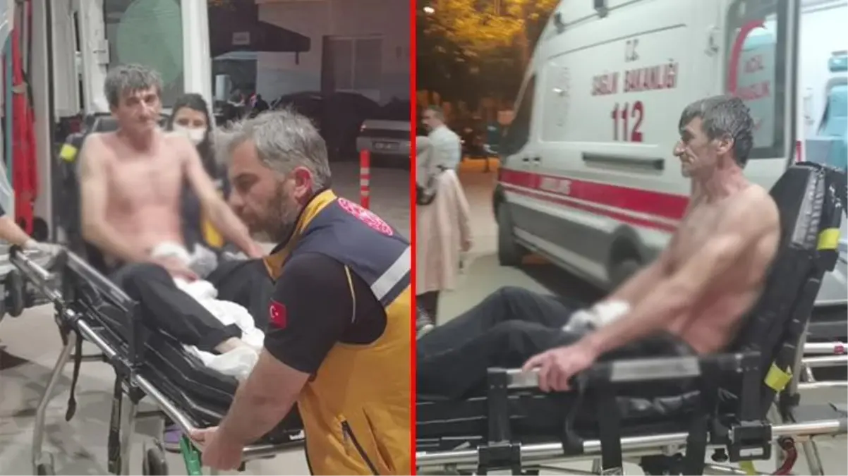 Mesai saatinde dehşeti yaşadı! Üzerine asit püsküren işçinin bedeninin yüzde 60'ı yandı