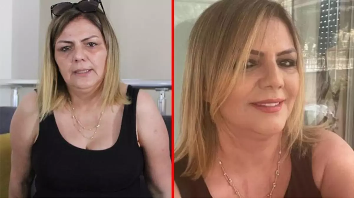 Estetik mağduru kadın doktora ateş püskürdü: Kasap gibi kesiyor, biçiyor