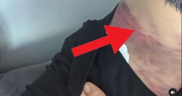 Hayatı boyunca vücudundaki hasarla yaşayacak! Alişan, eşi Buse Varol'la birlikte mahkemeye koştu