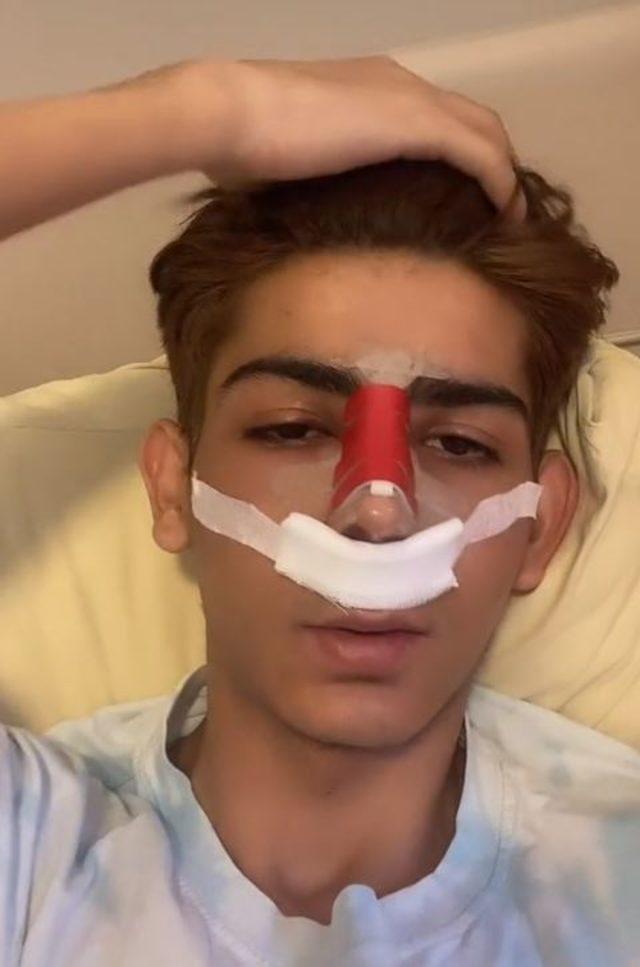 Fenomen Taha Duymaz estetik yaptırdı! Son halini görenler inanamıyor